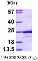 Human PTP4A2 / PRL-2 Protein (Recombinant His)