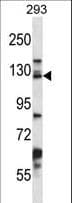 DSG2 / Desmoglein 2 Antibody (aa829-857)