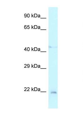 Polyclonal Rabbit anti-Rat TWIST1 / TWIST Antibody (N-Terminus, WB)