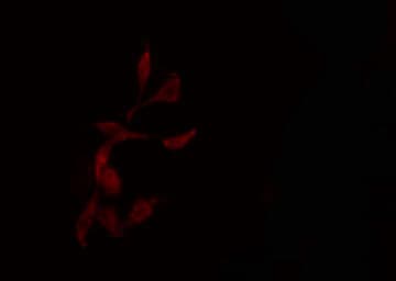 NCAPG / HCAP-G Antibody