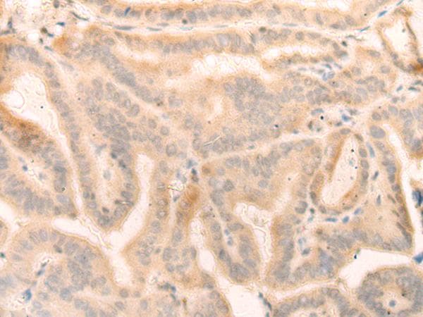 Polyclonal Rabbit anti-Human ELP4 Antibody (IHC)
