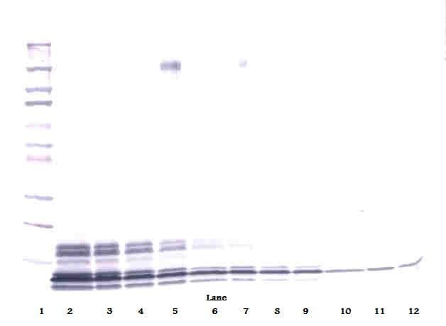 IHC-plus™ Polyclonal Rabbit anti-Human CXCL7 / PPBP Antibody (IHC, WB)
