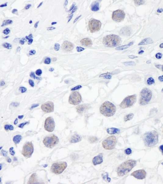 SMC3 / HCAP Antibody (aa1175-C-term)