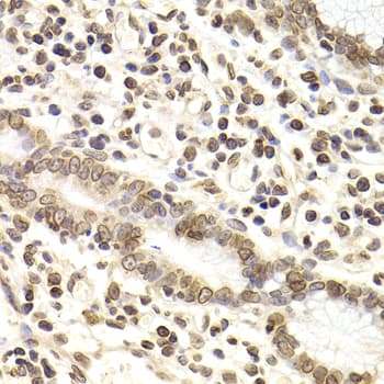 LAMB2 / Laminin Beta 2 Antibody
