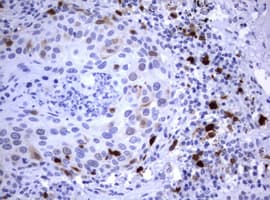 Monoclonal Mouse anti-Human TS / Thymidylate Synthase Antibody (clone OTI1D6, IHC, WB)