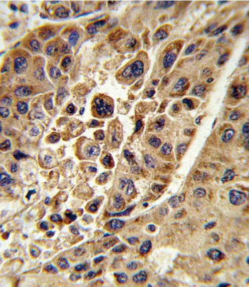 KMO Antibody (aa155-182)