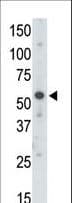 UBA3 / UBE1C Antibody (aa415-445)