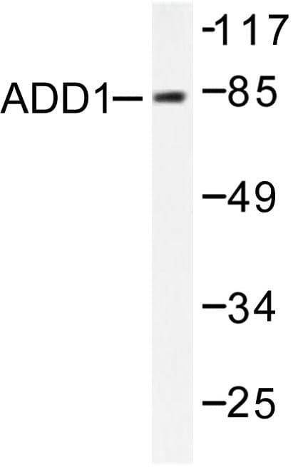 ADD1 / Adducin Alpha Antibody (Lys720)