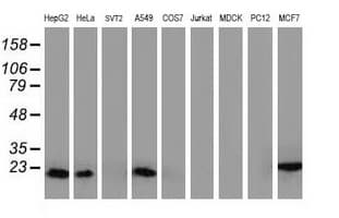 DSTN / Destrin Antibody (clone OTI1C8)