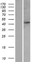 PRKAR1A Protein (Over-Expression Lysate Myc-DDK (Flag))