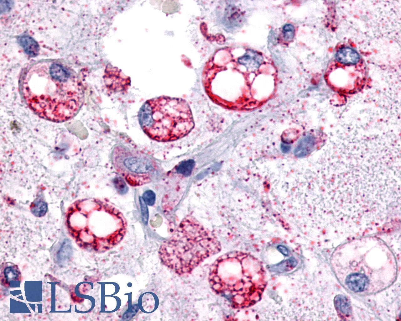 PathPlus™ Polyclonal Rabbit anti-Human GPR34 Antibody (Cytoplasmic Domain, IHC)