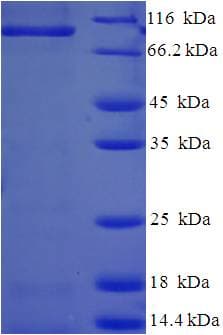 Rat CAPRIN1 Protein (Recombinant His-SUMO)