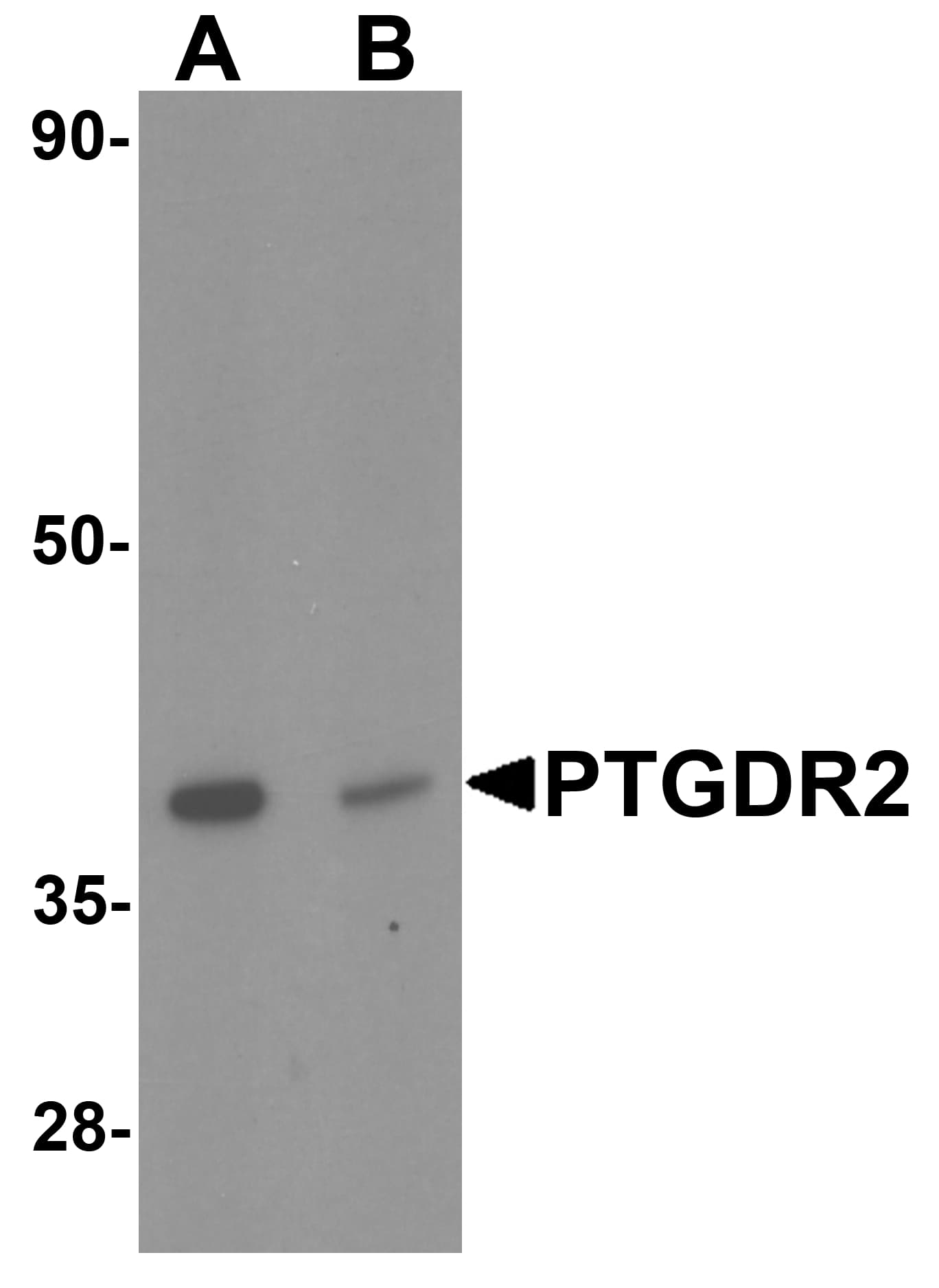 GPR44 / CRTH2 Antibody
