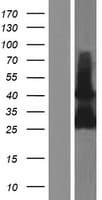 RAB33B Protein (Over-Expression Lysate Myc-DDK (Flag))