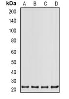PSMB2 Antibody