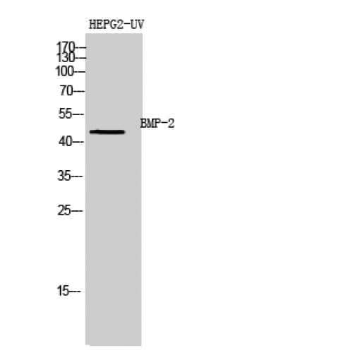 Polyclonal Rabbit anti-Human BMP2 Antibody (341-390 aa, C-terminal, IHC, WB)
