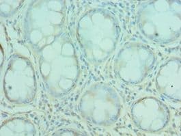 Polyclonal Rabbit anti-Human G3BP1 / G3BP Antibody (aa227-466, IHC, WB)