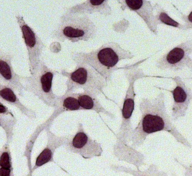 Goat Anti-Rabbit IgG Secondary Antibody (AP)
