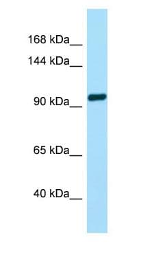 TAS1R2 / T1R2 Antibody (aa481-530)