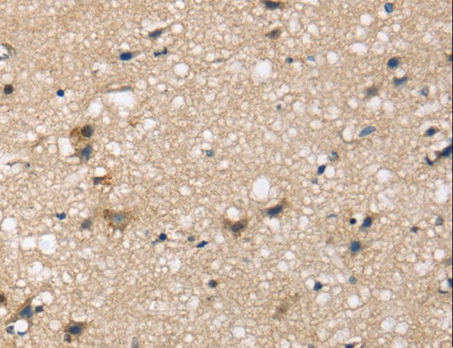 Polyclonal Rabbit anti-Human SEMA4A / Semaphorin 4A Antibody (IHC)