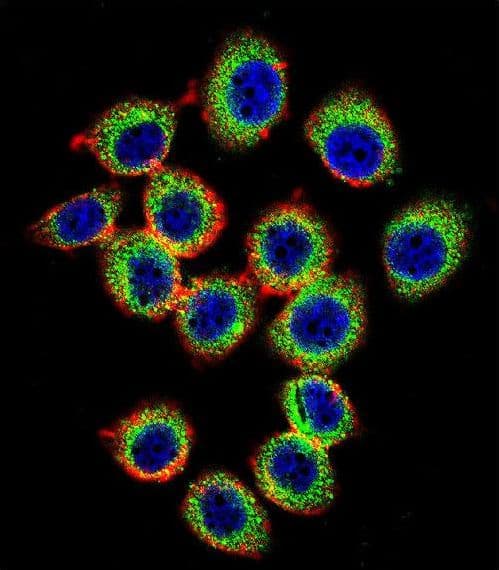 Polyclonal Rabbit anti-Human RASGRP2 Antibody (aa7-34, IHC, IF, WB)