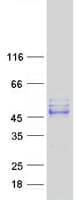 Human SEPT12 / Septin 12 Protein (Recombinant Myc-DDK (Flag))