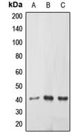 Polyclonal Rabbit anti-Human EPHX3 / Epoxide Hydrolase 3 Antibody (Internal, IHC, WB)