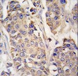 ACO2 / Aconitase 2 Antibody (aa294-325)