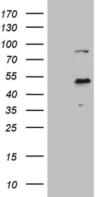 ELF3 / ESE1 Antibody (aa175-286, clone OTI7H9)