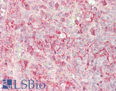 Polyclonal Rabbit anti-Human CD32A Antibody (aa69-309, IHC, WB)