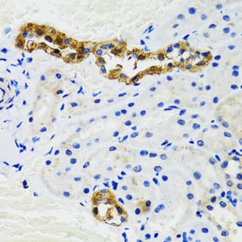 Polyclonal Rabbit anti-Human ODC1 / Ornithine Decarboxylase Antibody (IHC, WB)