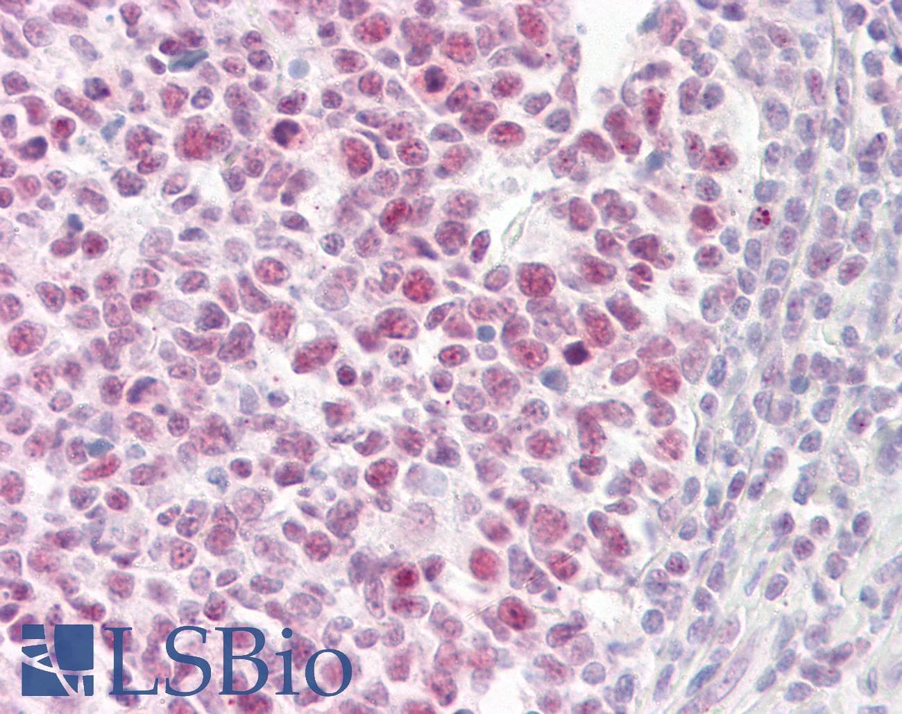 IHC-plus™ PIAS4 / PIASY Antibody (aa451-500)