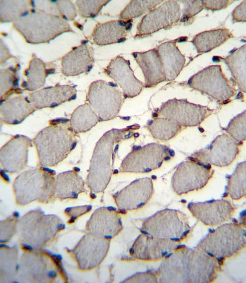 DDX60L Antibody (aa1200-1228)