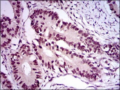 E2F1 Antibody (Amino Acid: 69-223, clone 8G9)
