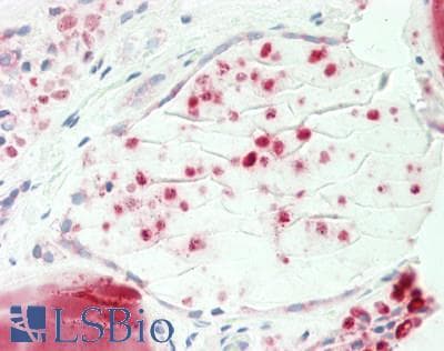 Polyclonal Rabbit anti-Human PDE1A Antibody (C-Terminus, IHC, WB)
