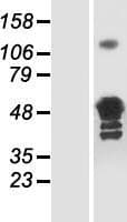 GLUL / Glutamine Synthetase Protein (Over-Expression Lysate Myc-DDK (Flag))