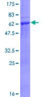 Human AURKC / Aurora C Protein (Recombinant GST)