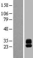 C6orf25 Protein (Over-Expression Lysate Myc-DDK (Flag))