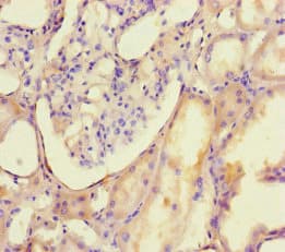 DNMT3B Antibody