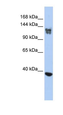SMARCA1 / SWI Antibody (aa35-84)