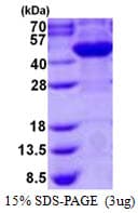 Human AS3MT Protein (Recombinant His)