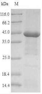 Human CHRNA1 Protein (Recombinant TRX-6His, N-terminus)