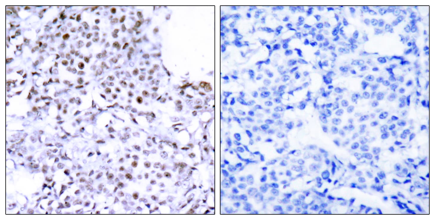 SMC1A / SMC1 Antibody (aa931-980)