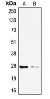 SIP / TP53INP1 Antibody (C-Terminus)