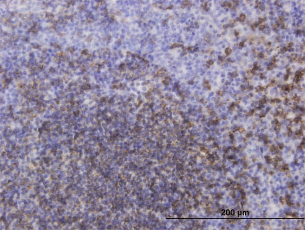 CD20 Antibody (aa1-298, clone 4F11)