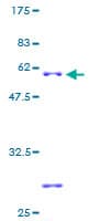 Human SLC25A17 Protein (Recombinant GST)