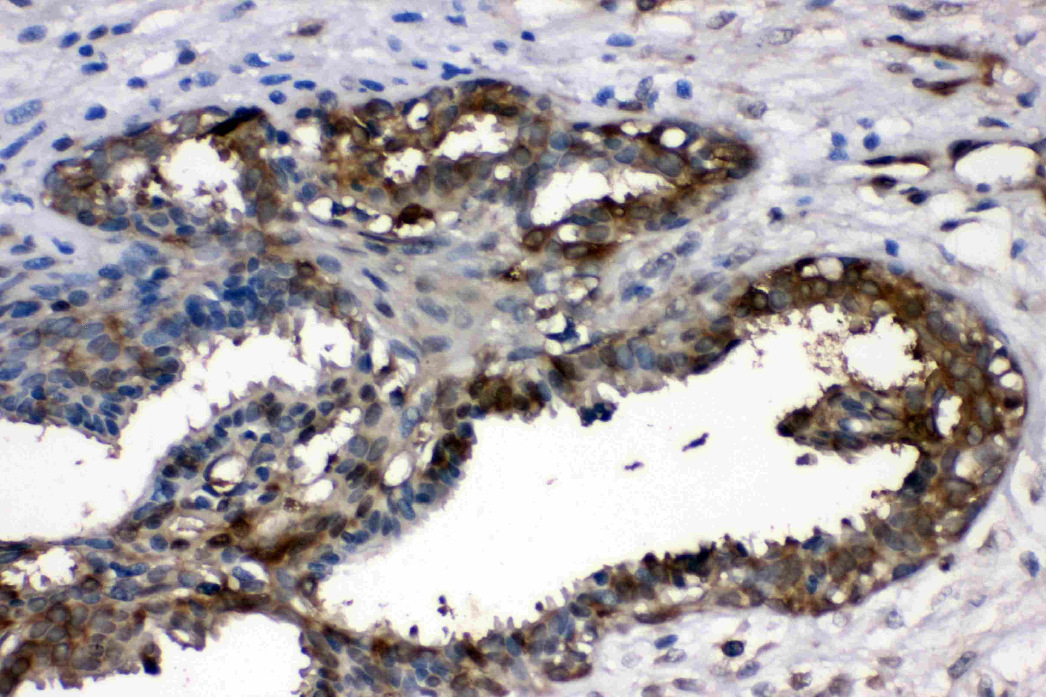 Polyclonal Rabbit anti-Human LDHA / LDH1 Antibody (IHC, WB)