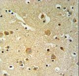 Polyclonal Rabbit anti-Human PLEKHH2 Antibody (aa1049-1079, IHC, WB)