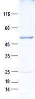 Human RNF144A / RNF144 Protein (Recombinant GST, N-terminus + His, C-terminus)