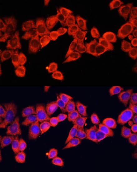 IL-1B / IL-1 Beta Antibody
